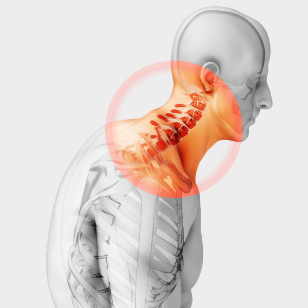 neck pain