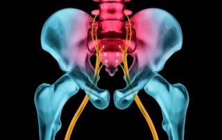 Sciatica Exercises
