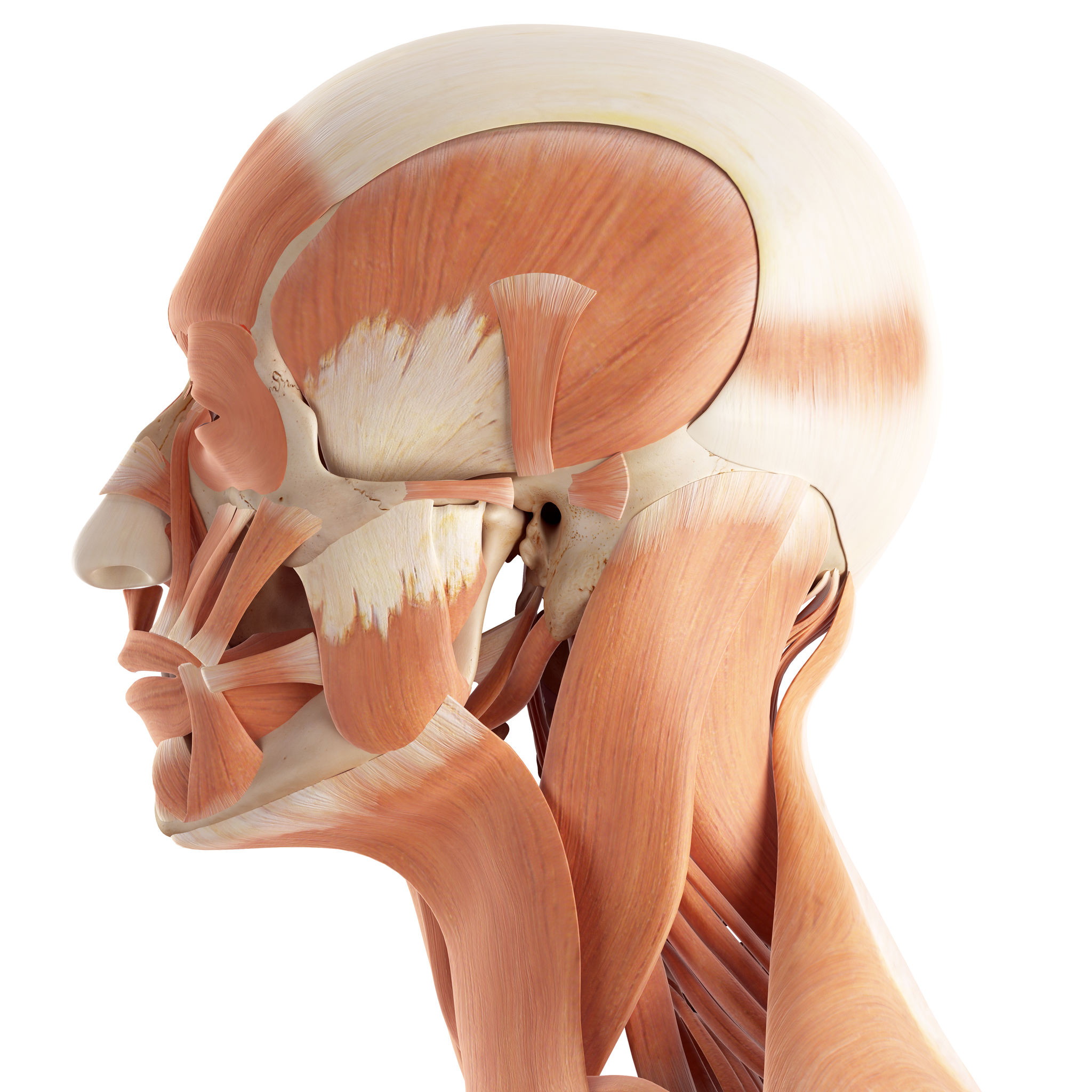 tension headache