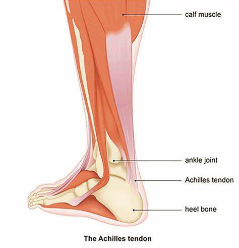 Achilles tendon