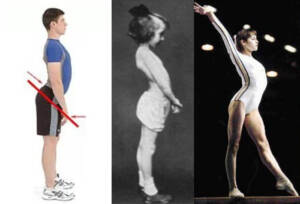 Anterior pelvic tilt