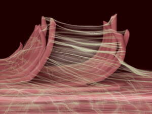 Fascial adhesions