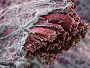 Fascia