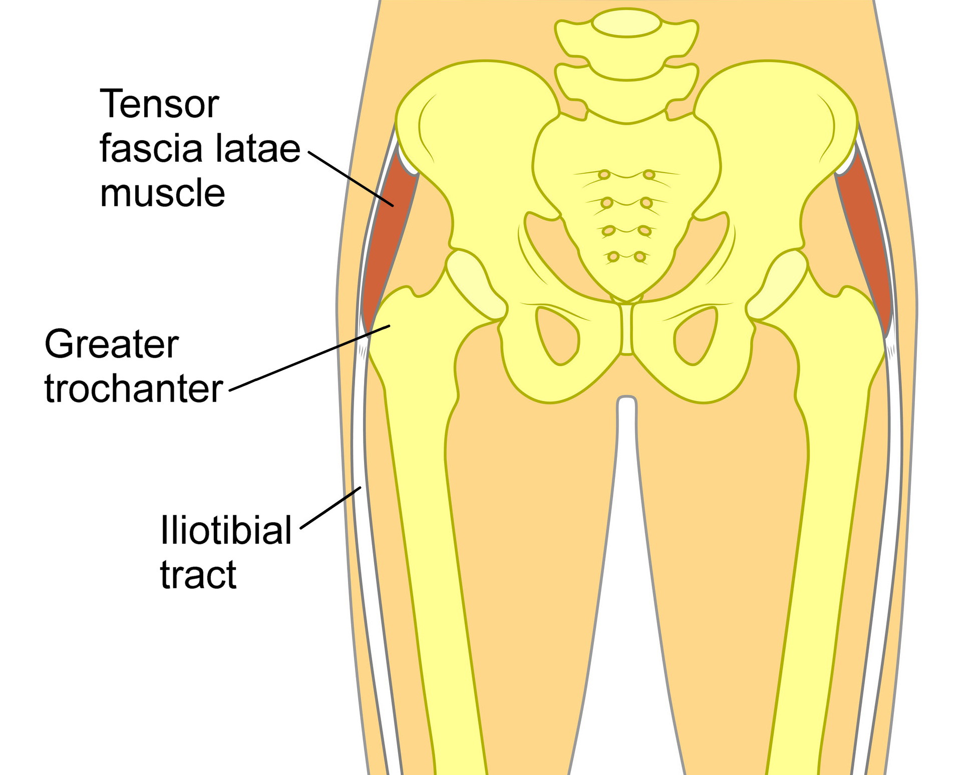 Snapping hip syndrome