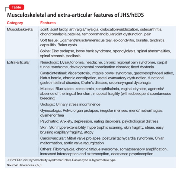 Joint Hypermobility