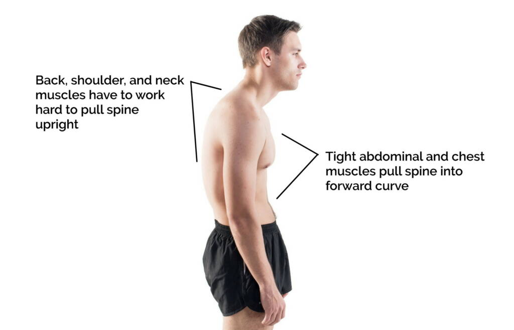 Postural Kyphosis Tight Muscles 