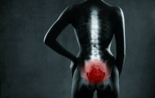 Pelvic Pain