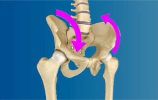 Pelvic torsion twisted pelvis