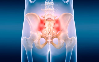 SI joint pain