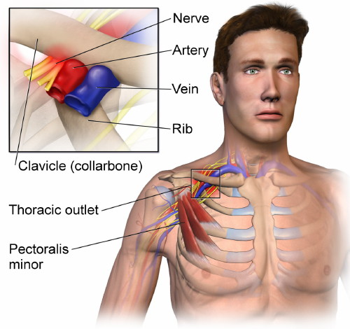 Thoracic outlet