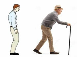 Stooped posture 